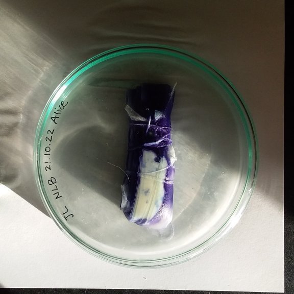 alice-bacteria-week04